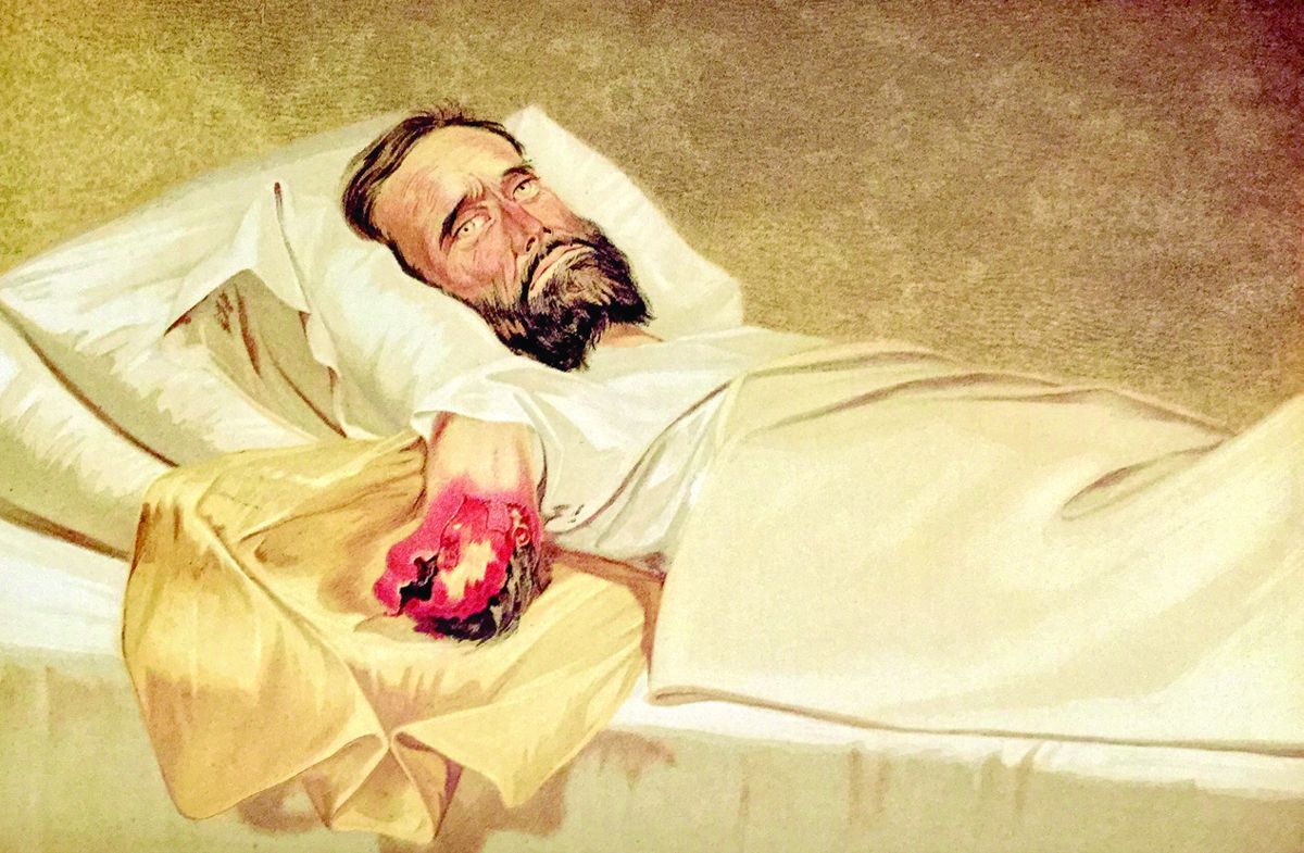 Medical and Surgical History of the Civil War — lead photograph from the original article