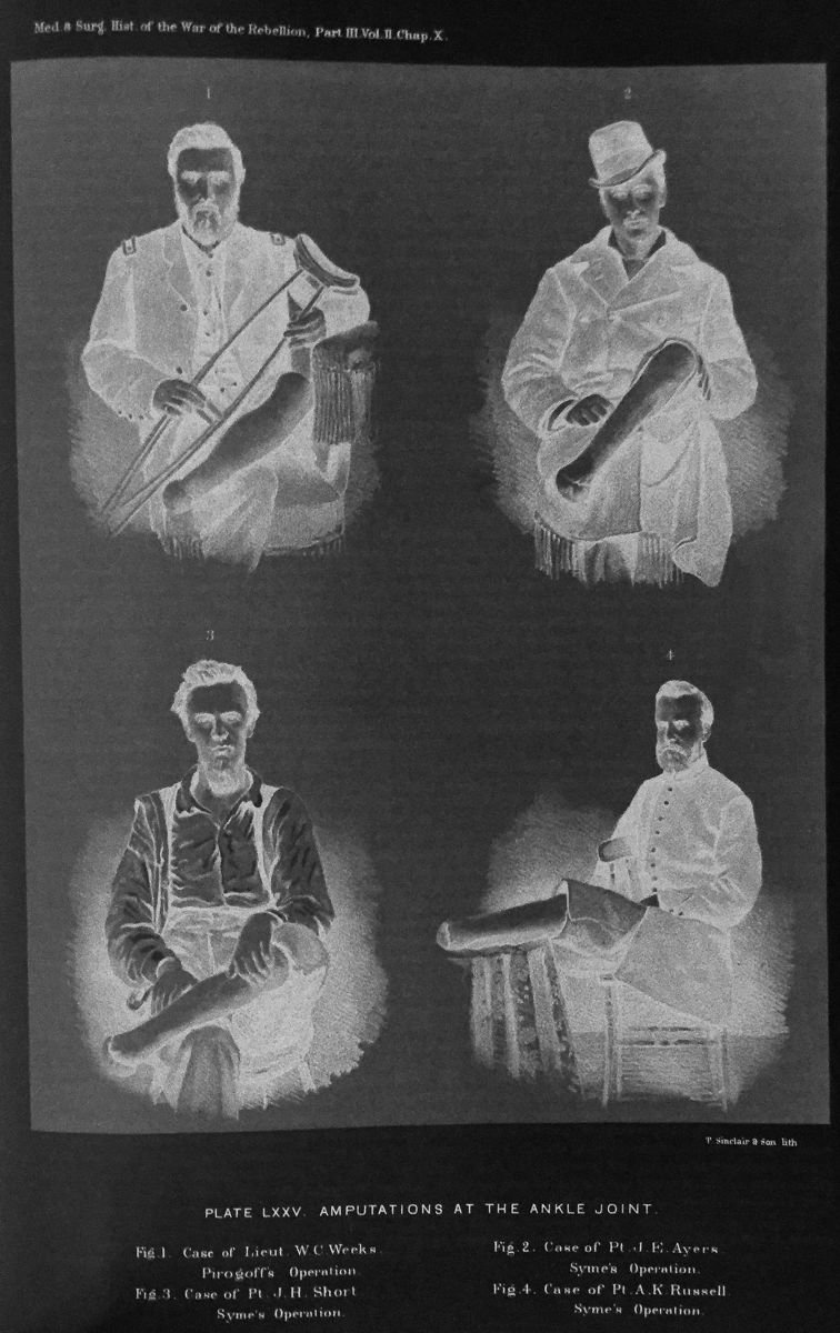 Woodcut illustration of amputees.
