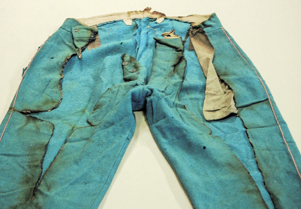 Upper part of trousers, front, before treatment.
