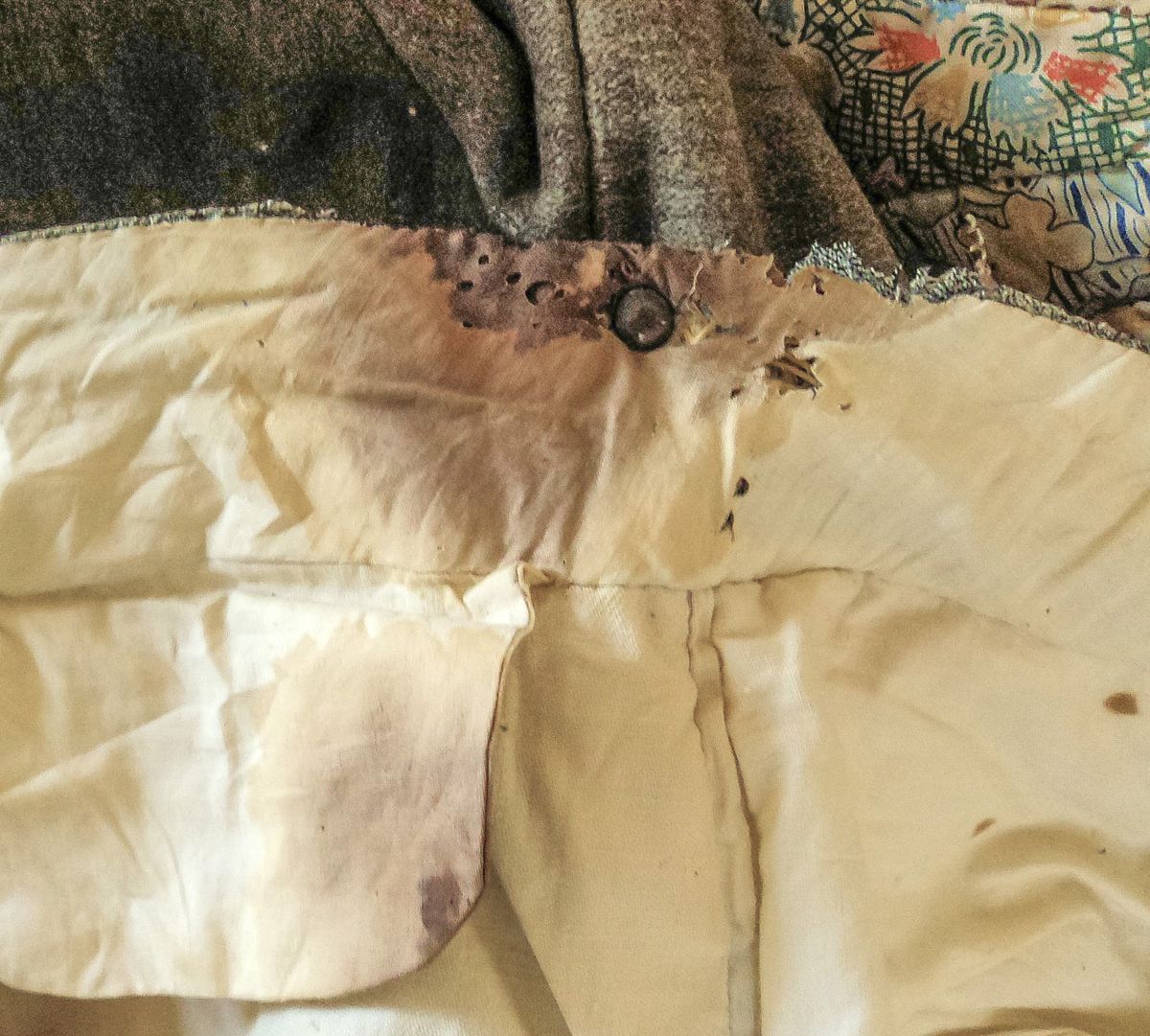 Note where the acids in Hale’s blood continued to eat the lining of his trousers for years afterward.